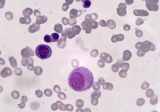 血細胞成像 - TrueChrome HDMI 相機